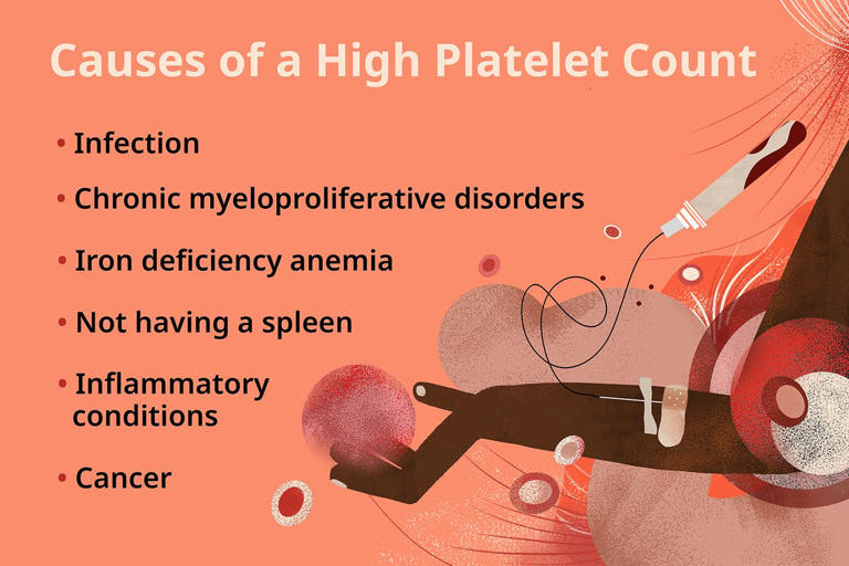 Should you be concerned about high platelets?
