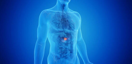 Il tumore al pancreas subdolo e aggressivo, ecco come riconoscerlo