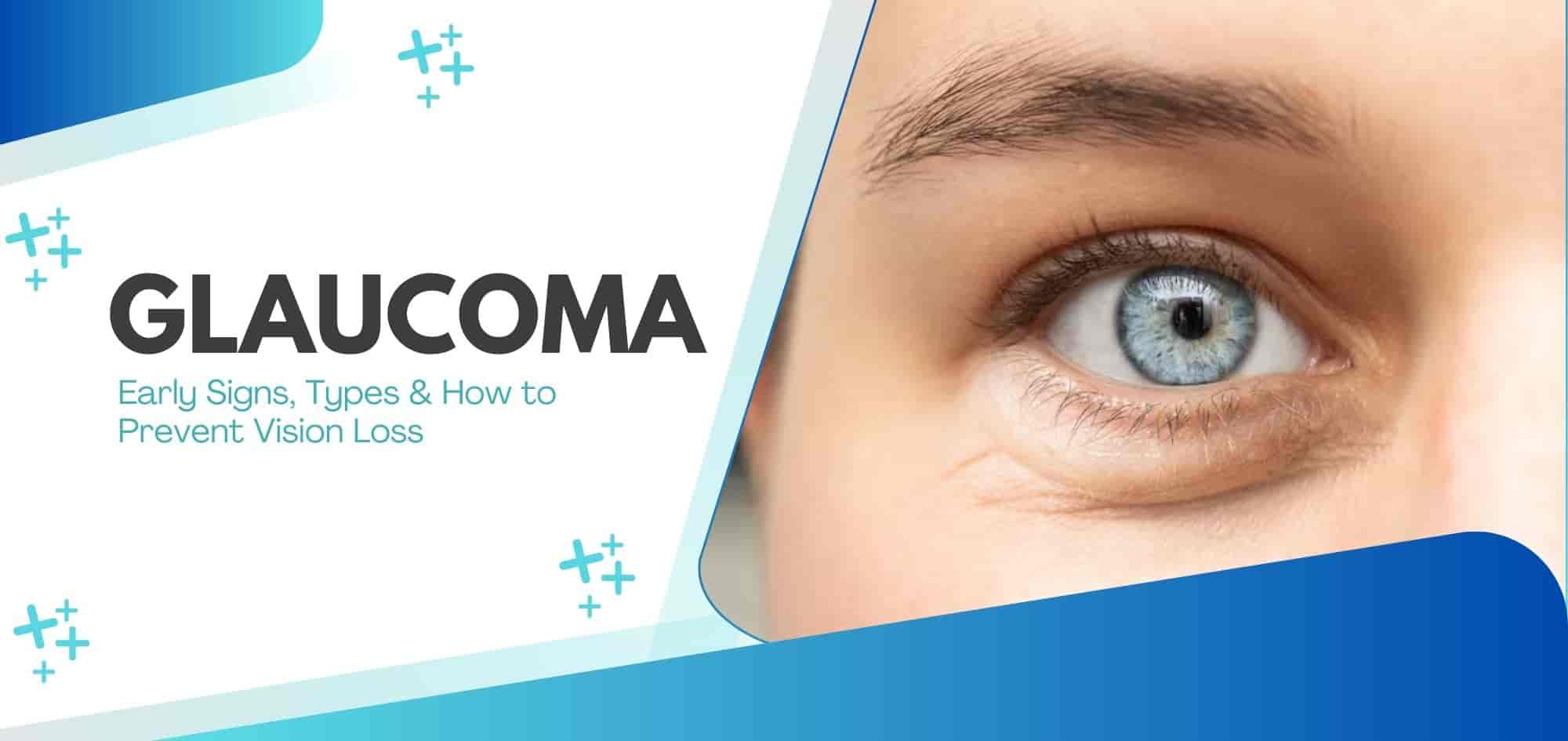 Glaucoma disease 101: Everything you need to know to protect your vision