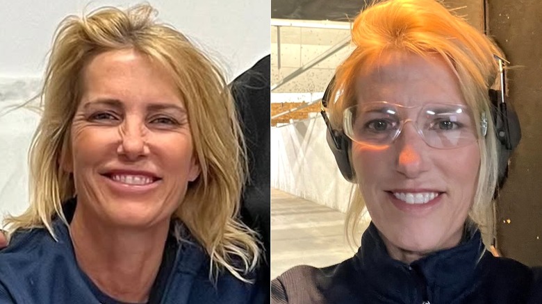 Featured - Laura Ingraham Nose Job