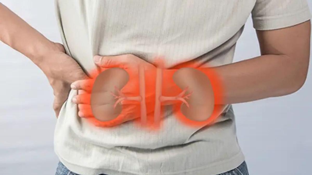 Doctors say early detection is the most powerful way to prevent chronic kidney disease<br><br>