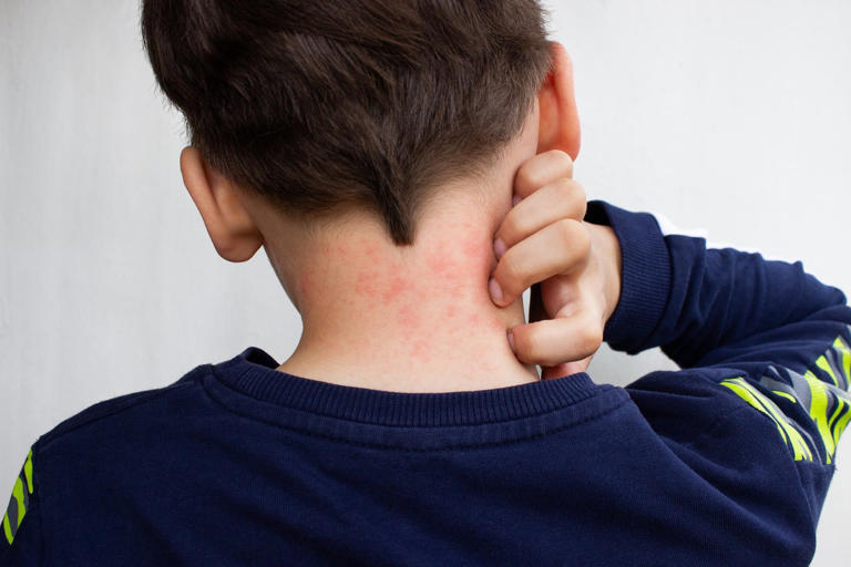 When to worry about children’s fevers, coughs and head injuries