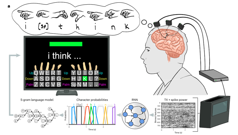 An experimental brain implant allows people with paralysis to type ...