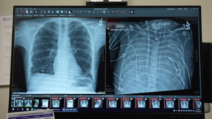 Kỳ tích y khoa: Sống sót 48 giờ không cần phổi