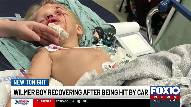 5-year-old boy hospitalized after being hit by car in Wilmer