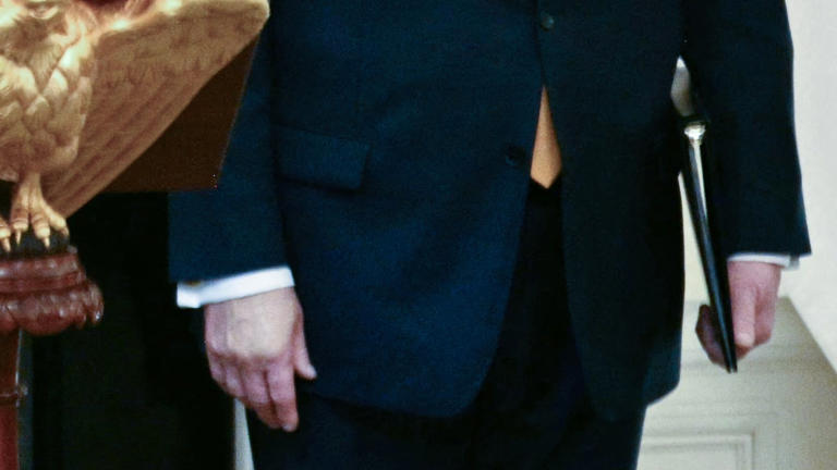 Trump’s hideously bruised hand makes appearance at White House dinner