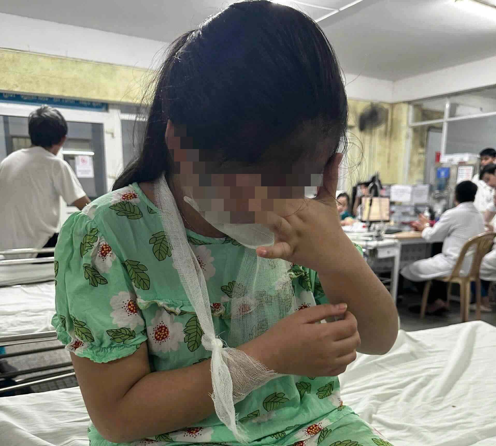 Xác minh vụ học sinh lớp 4 ở Huế bị gãy tay ở lớp học