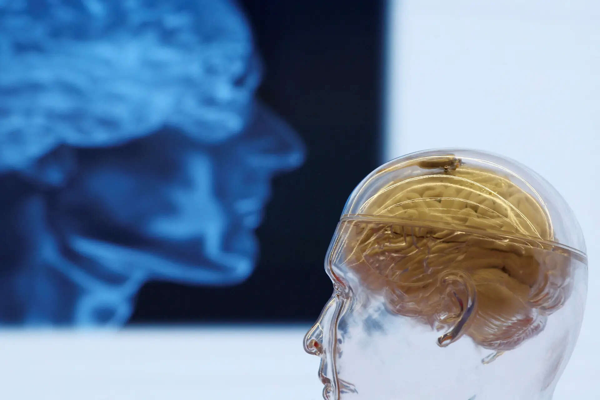 Beijing Elevates Brain-Chips to Strategic Priority as Domestic Tech Trails Neuralink