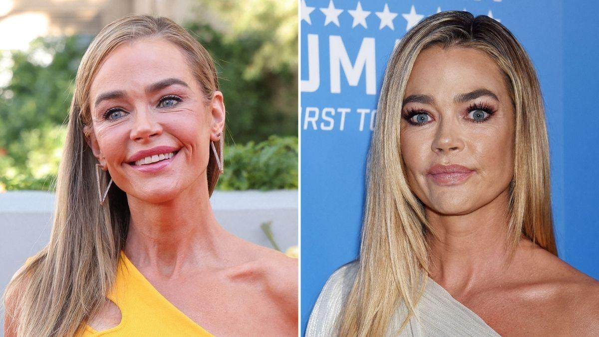 Denise Richards was 'terrified' before undergoing a facelift in 2025