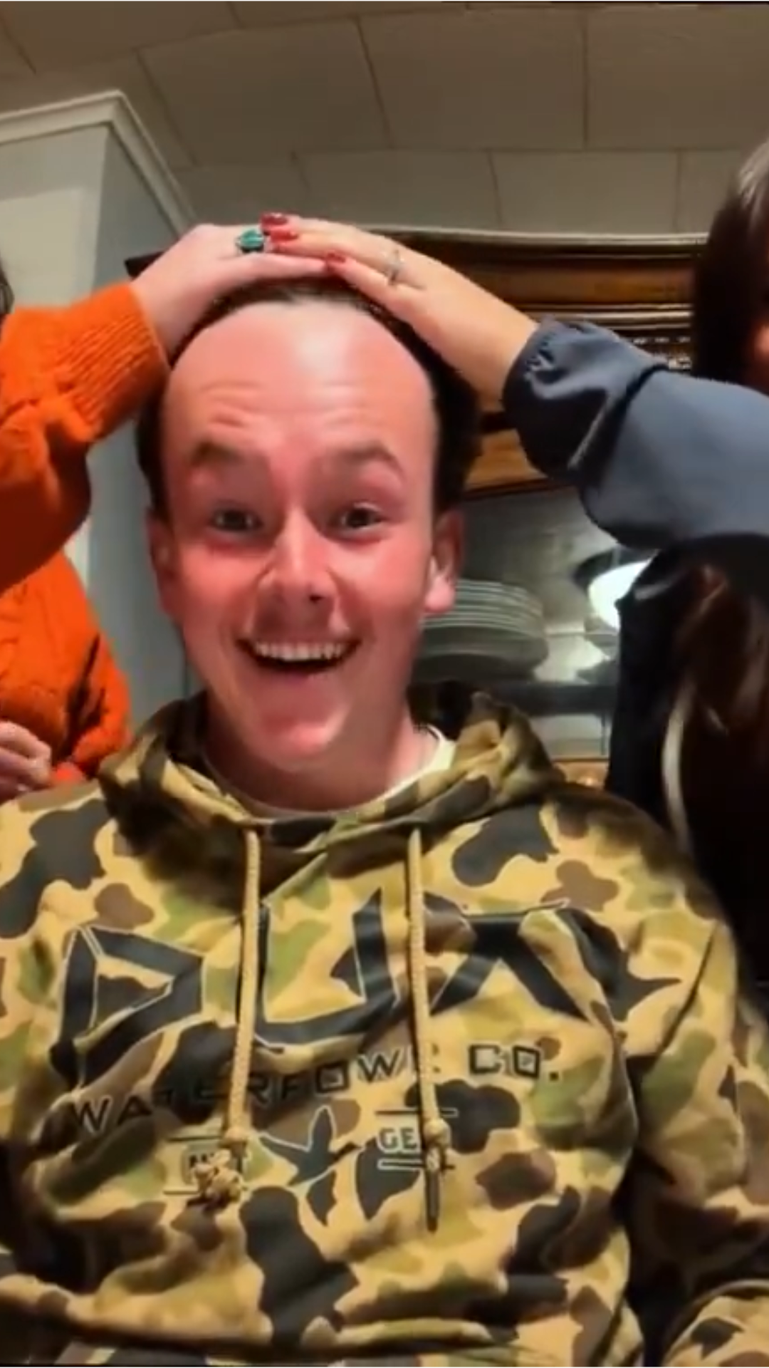Hairline reveal is shocking men on how bad their situation actually is