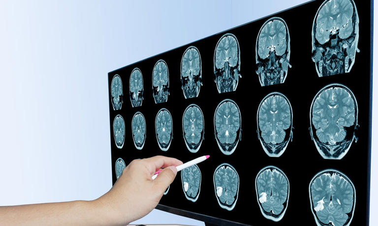 Why you're always tired, struggling with brain fog and lack of ...