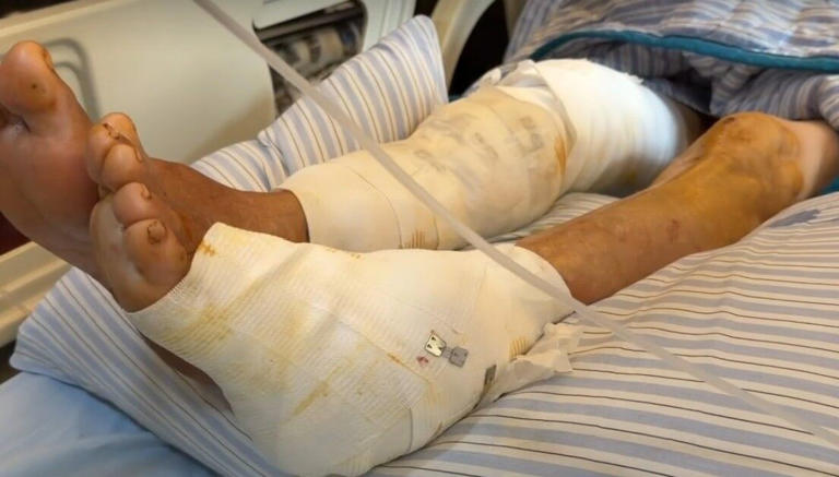 嬤遭瘋狂撕咬縫200針險死！3惡犬離奇消失　疑被養雞場帶走藏匿