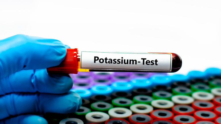 Yes, you can consume too much potassium: Here's what happens when you do