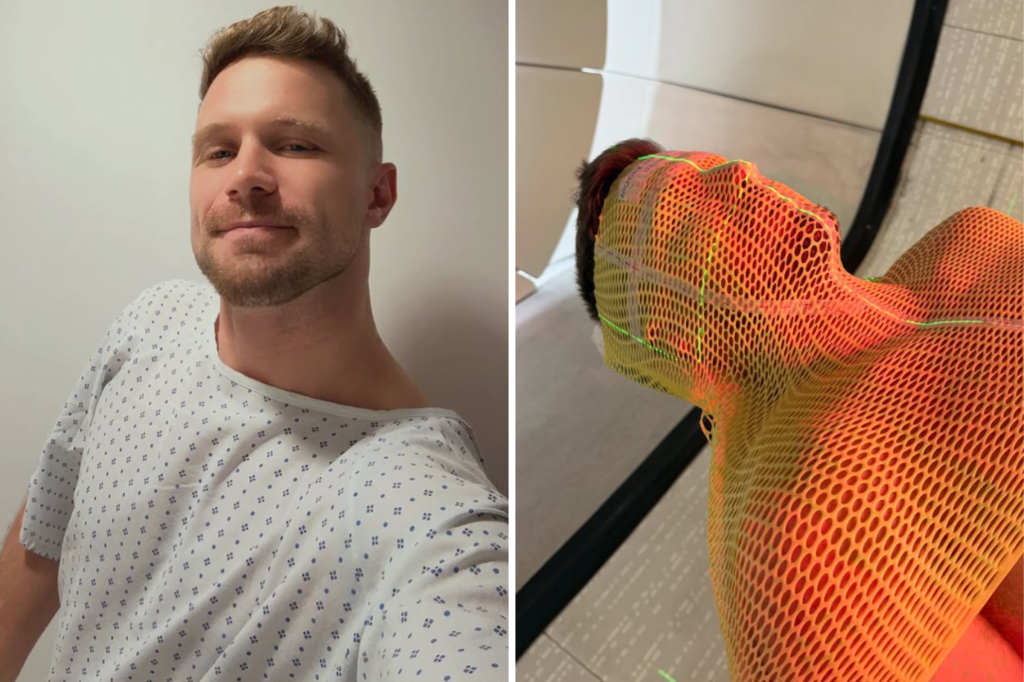 AA1Z7T96 Man, 32, Ignored Headaches—Then the Shocking Diagnosis