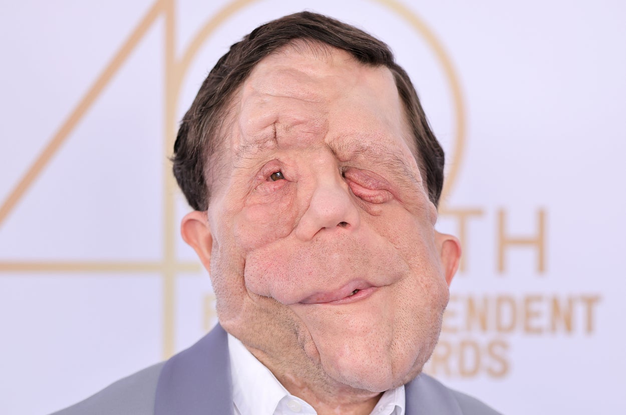 A comedian mocked Adam Pearson's appearance at the Oscars, and people ...