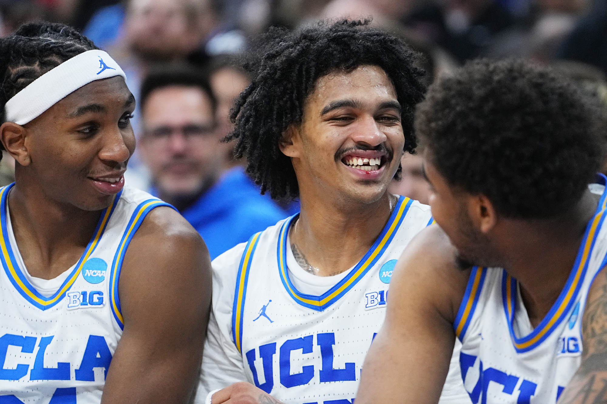 Skyy Clark tooth update from NCAA tournament
