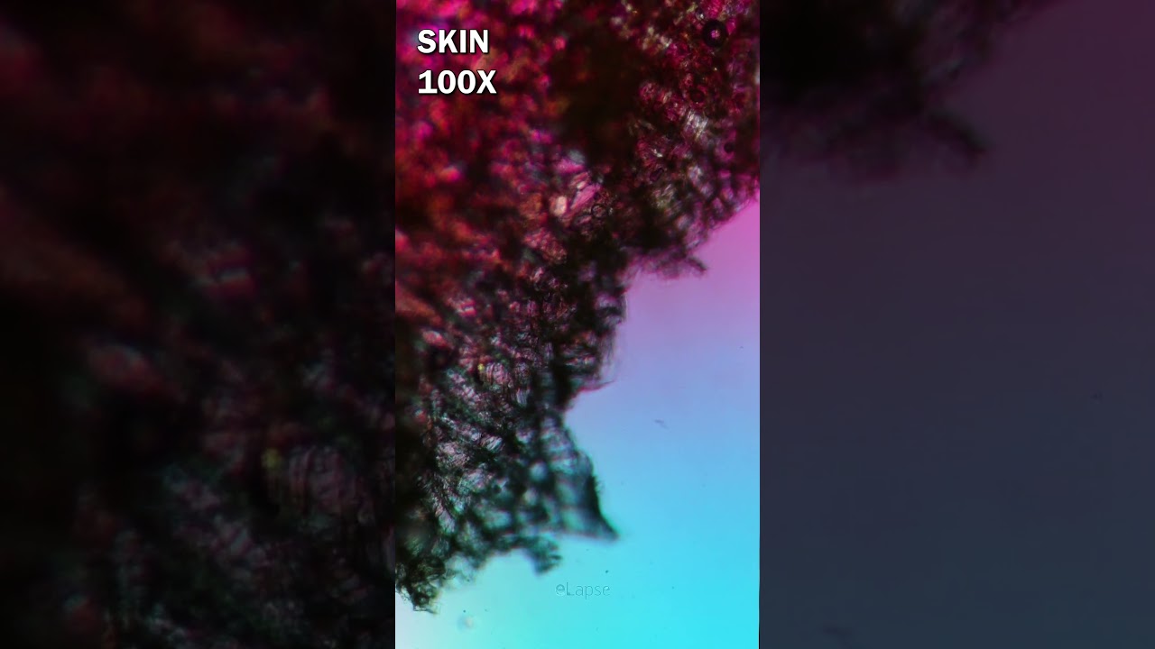 Potato under microscope