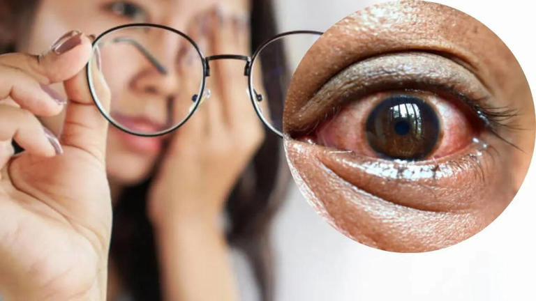 your eyes are warning you, 5 silent signs you should never ignore