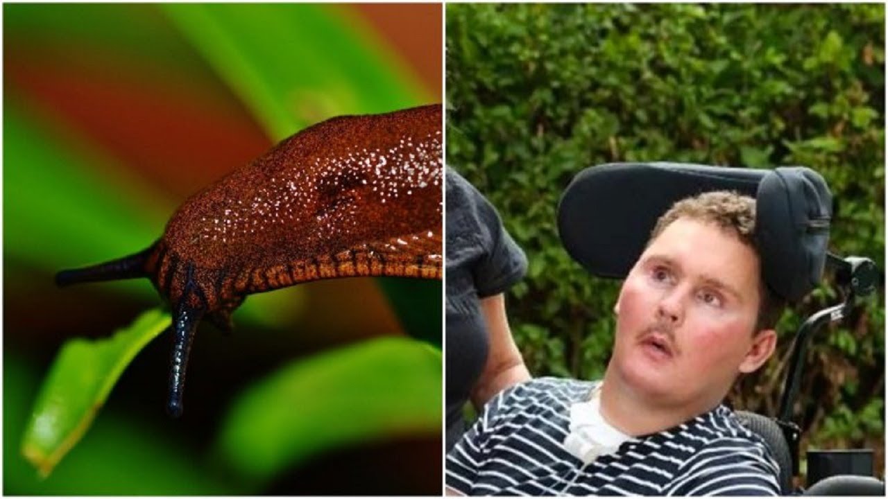A teenage rugby player was dared to swallow a slug – and it tragically ...