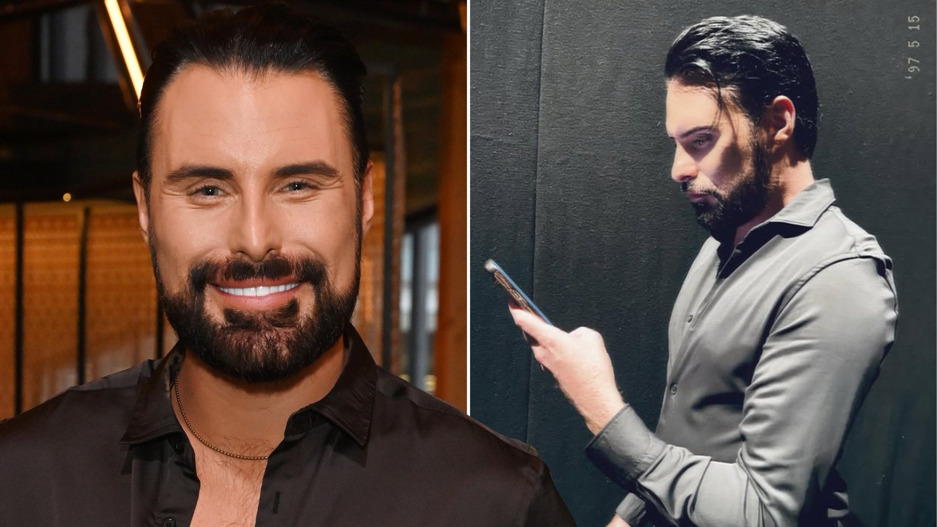 Rylan Clark reveals latest cosmetic surgery that was 'such a trauma'