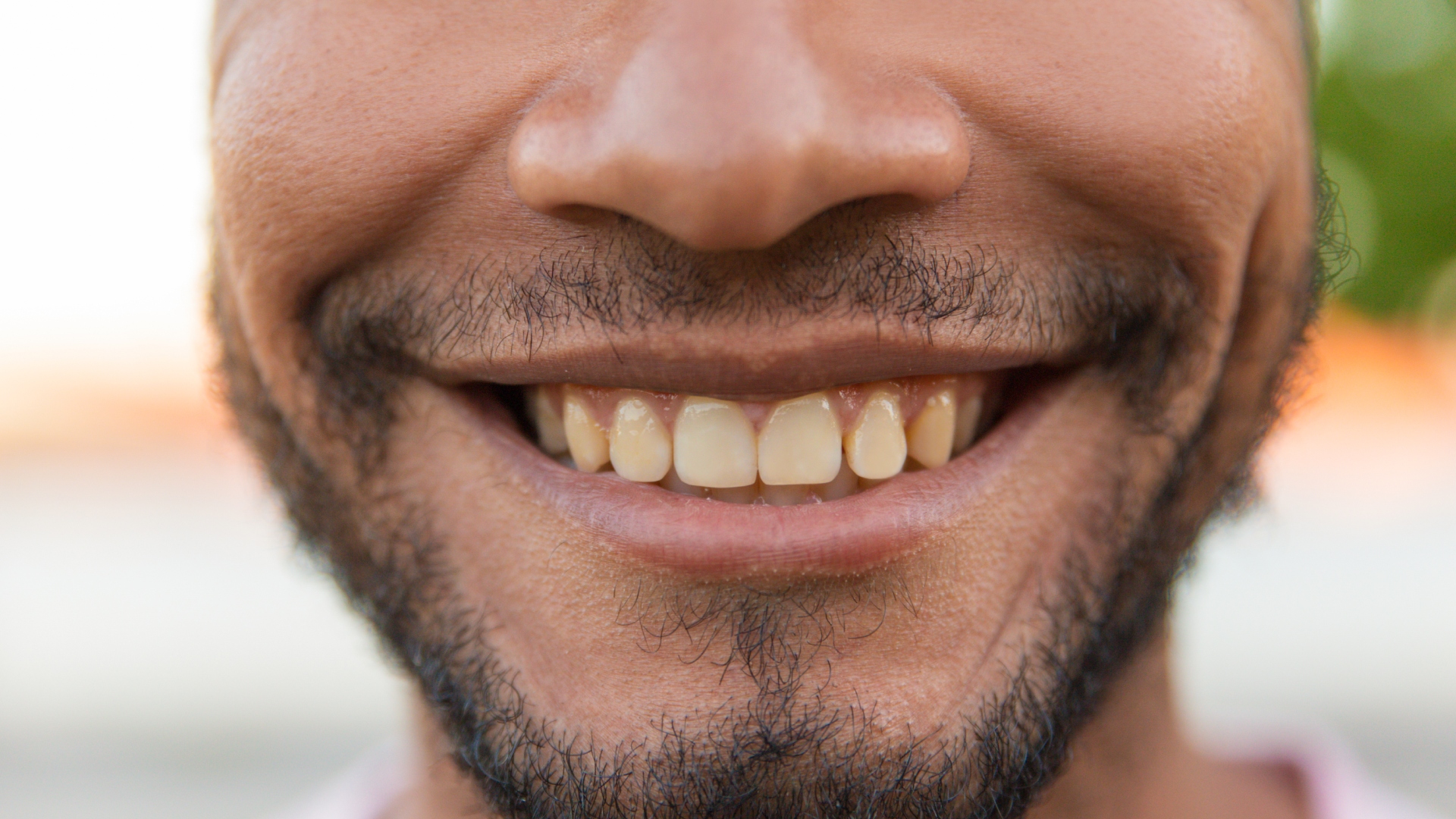 These eating habits could be linked to yellowing teeth