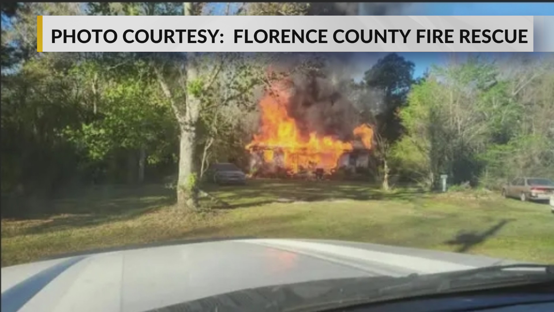 One person burned in Florence County house fire