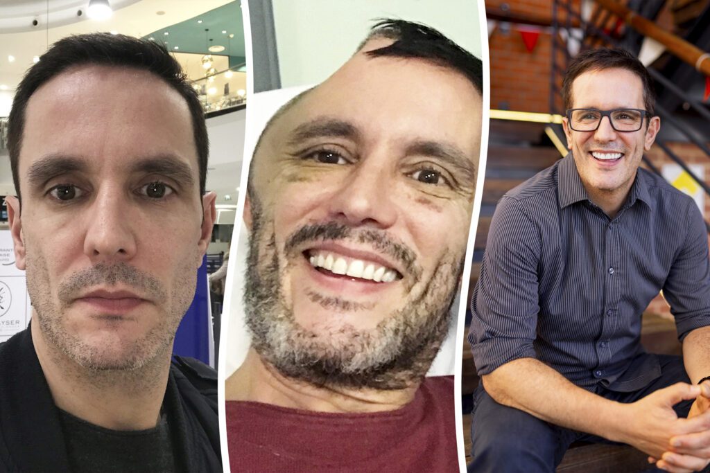 Man loses 'half his head' after slip and fall at Tube station