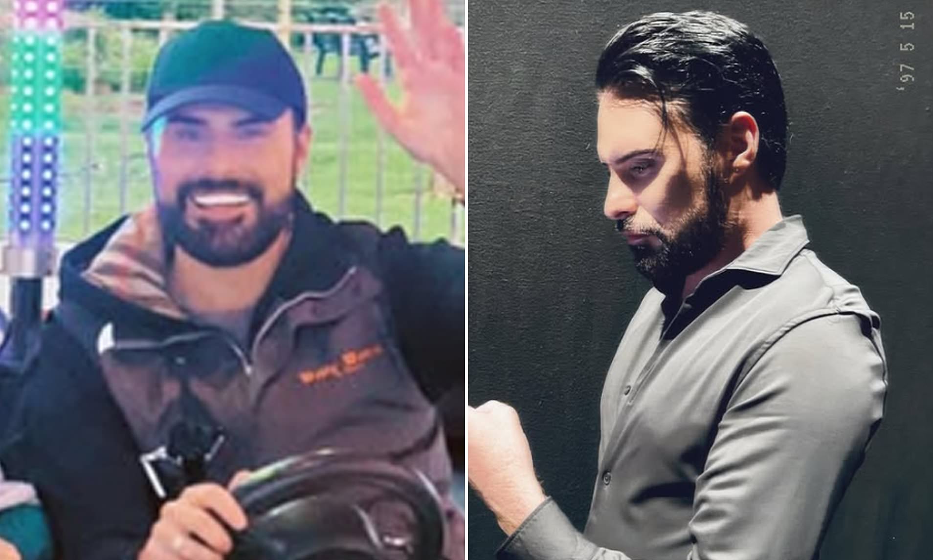 Rylan Clark shows off results of 'invasive tweakments' as procedures he ...
