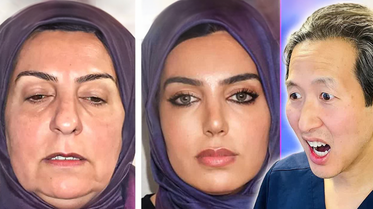 Plastic surgeon reviews cosmetic surgery results from Turkey