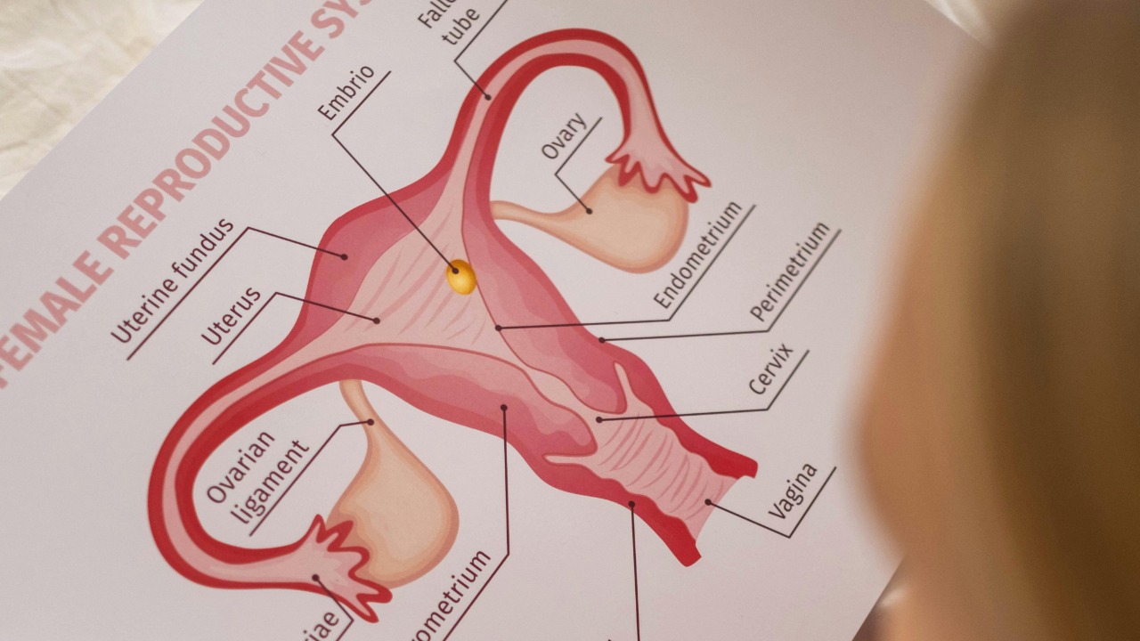 Endometriosis may disrupt immunity, triggering bodywide effects<br><br>