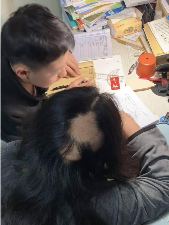 Rụng tóc từng mảng sau khi liên tục thức đêm kèm con học