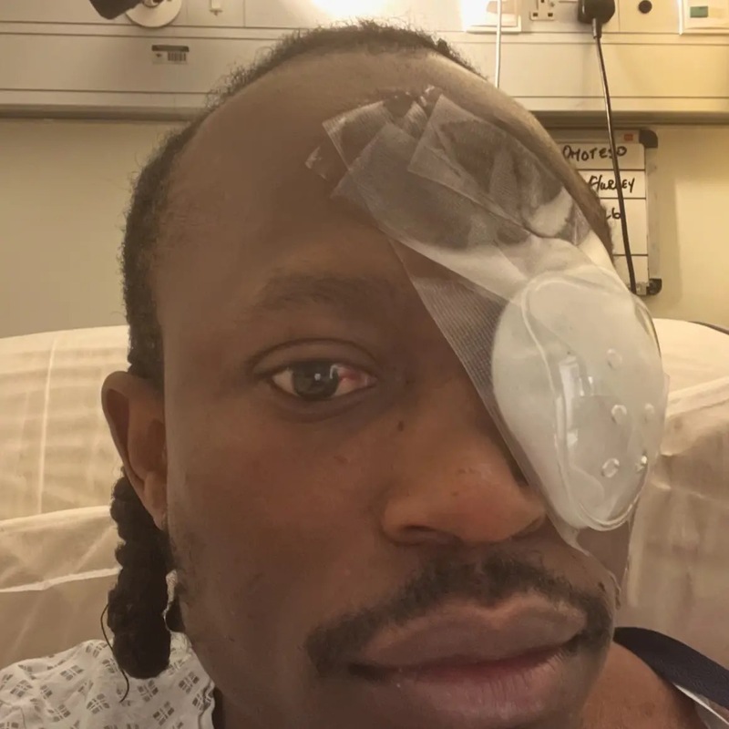 Gardaí investigating after Limerick hip hop artist partially blinded in ...