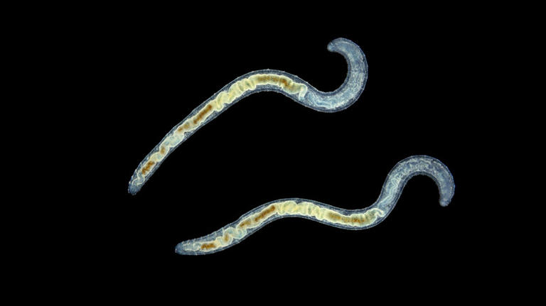 12 types of worms you can find in your garden (and what they say about ...