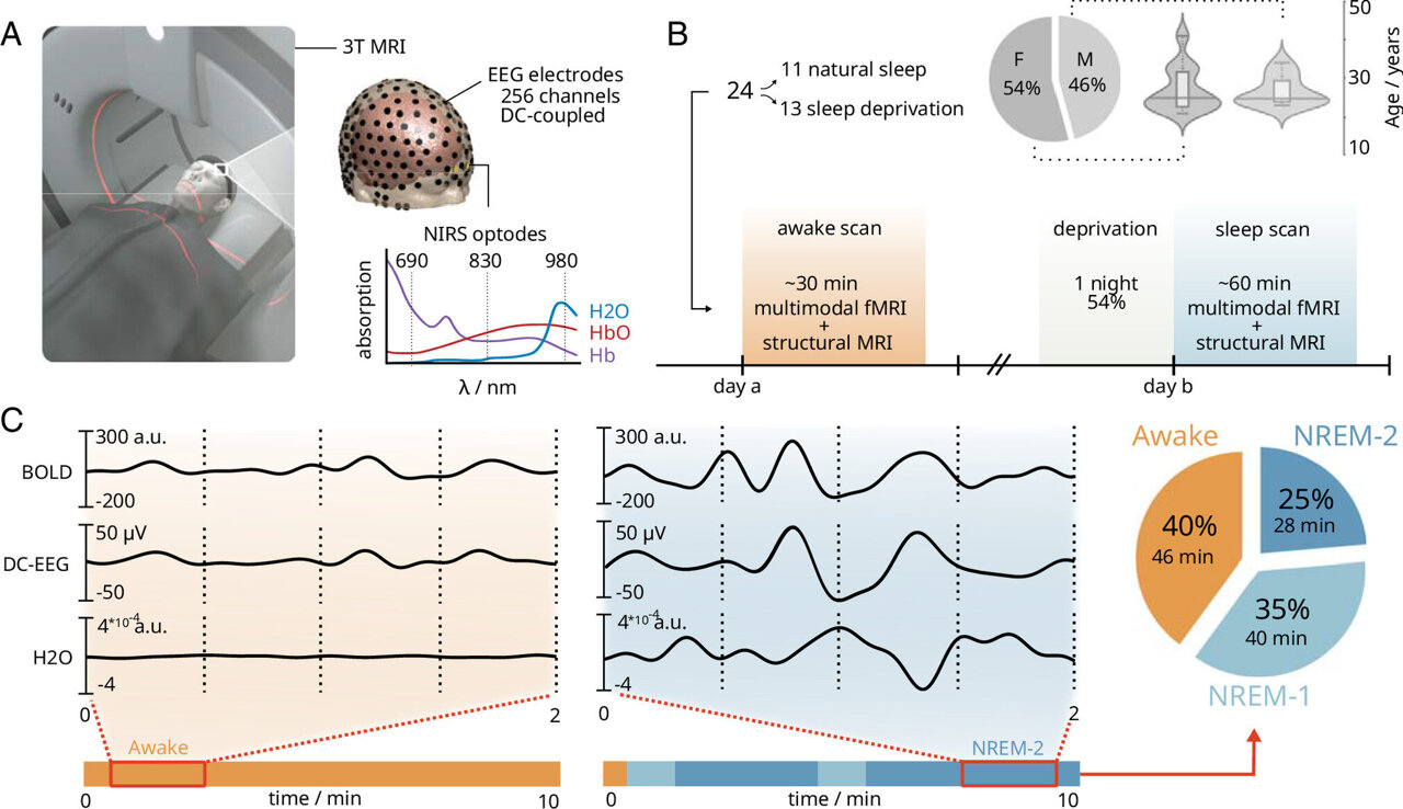 Sleep cleans the brain: Researchers develop fast, non-invasive way to ...