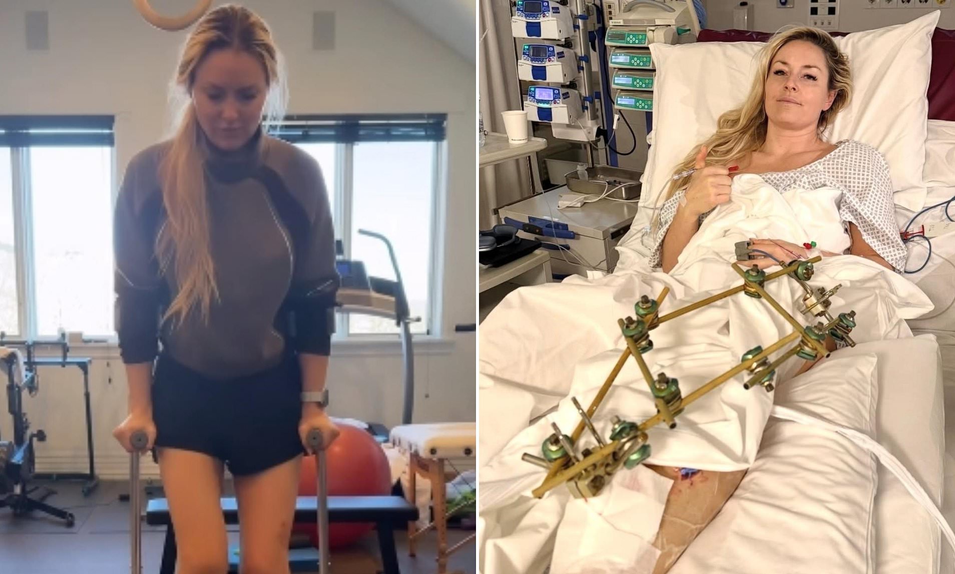 Lindsey Vonn shows incredible progress, walks for first time since ...