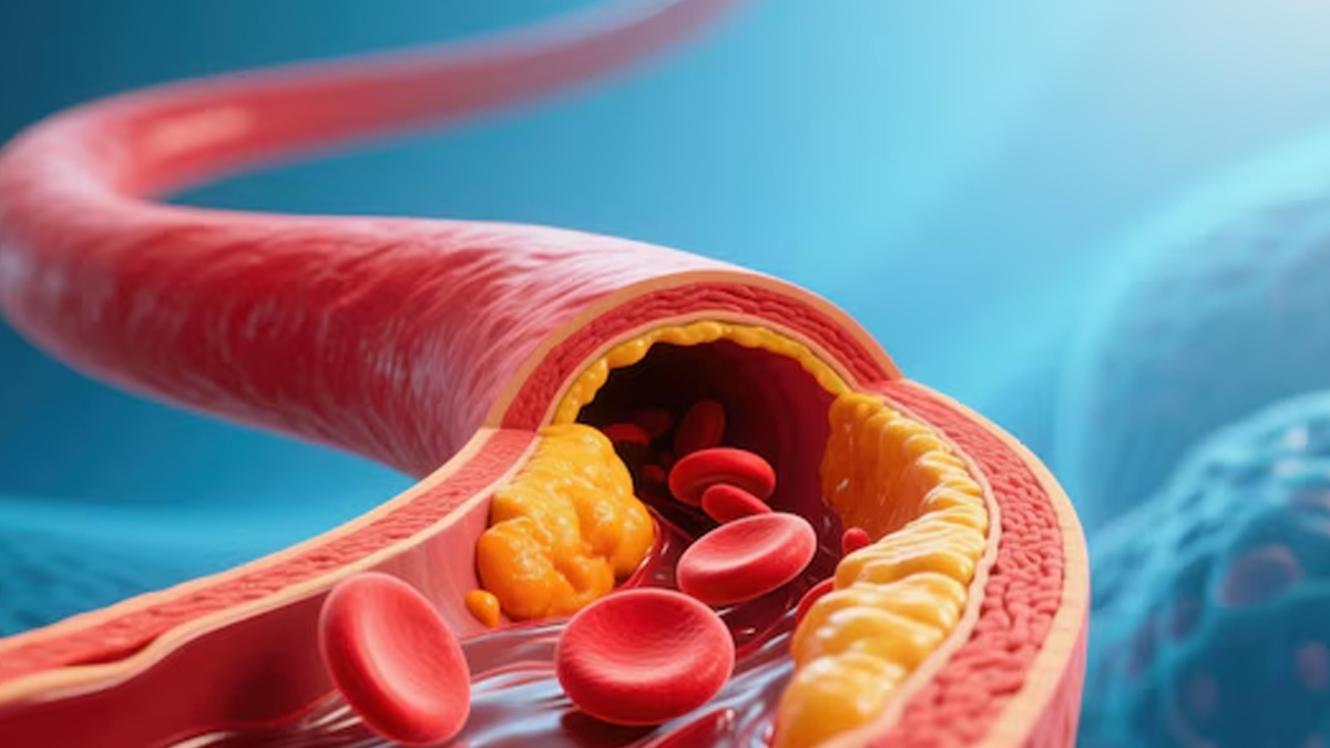 LDL vs HDL cholesterol: Experts explain the differences