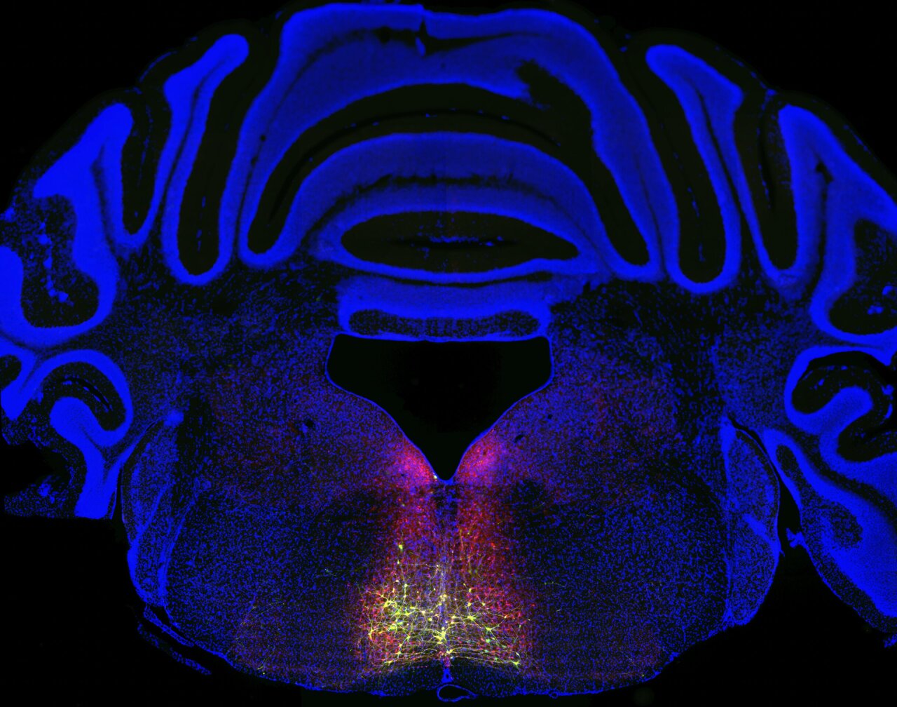 Scientists map brain loop driving chronic pain