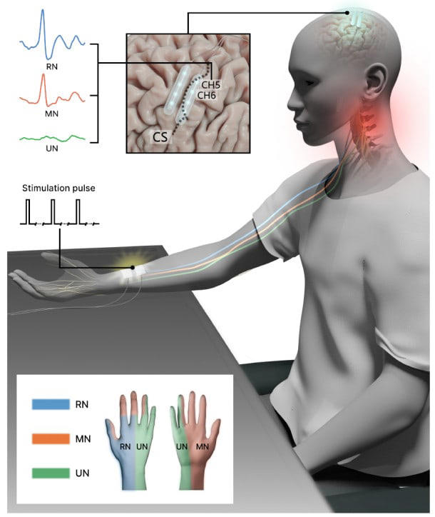 China beat Elon Musk’s Neuralink to approve the world’s first ...