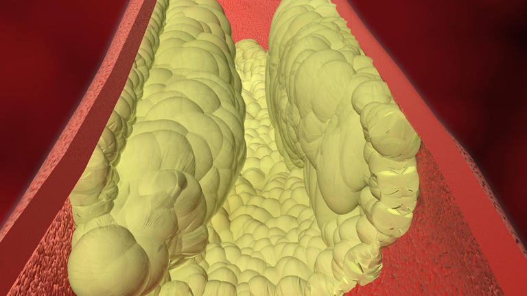 Take cholesterol levels seriously in your 30s, new guidelines warn