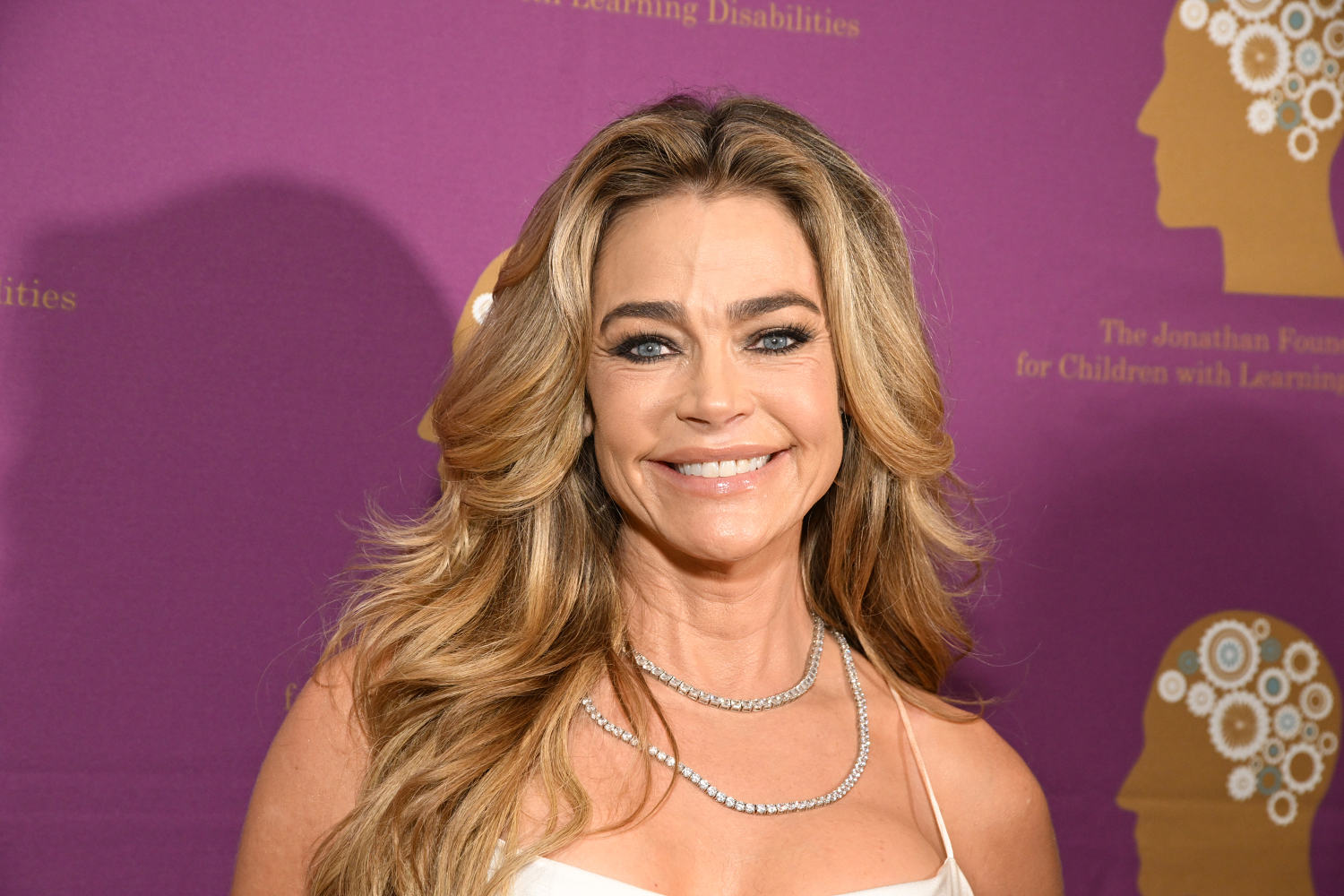 Denise Richards agrees The results of her facelift are 'shocking.' See