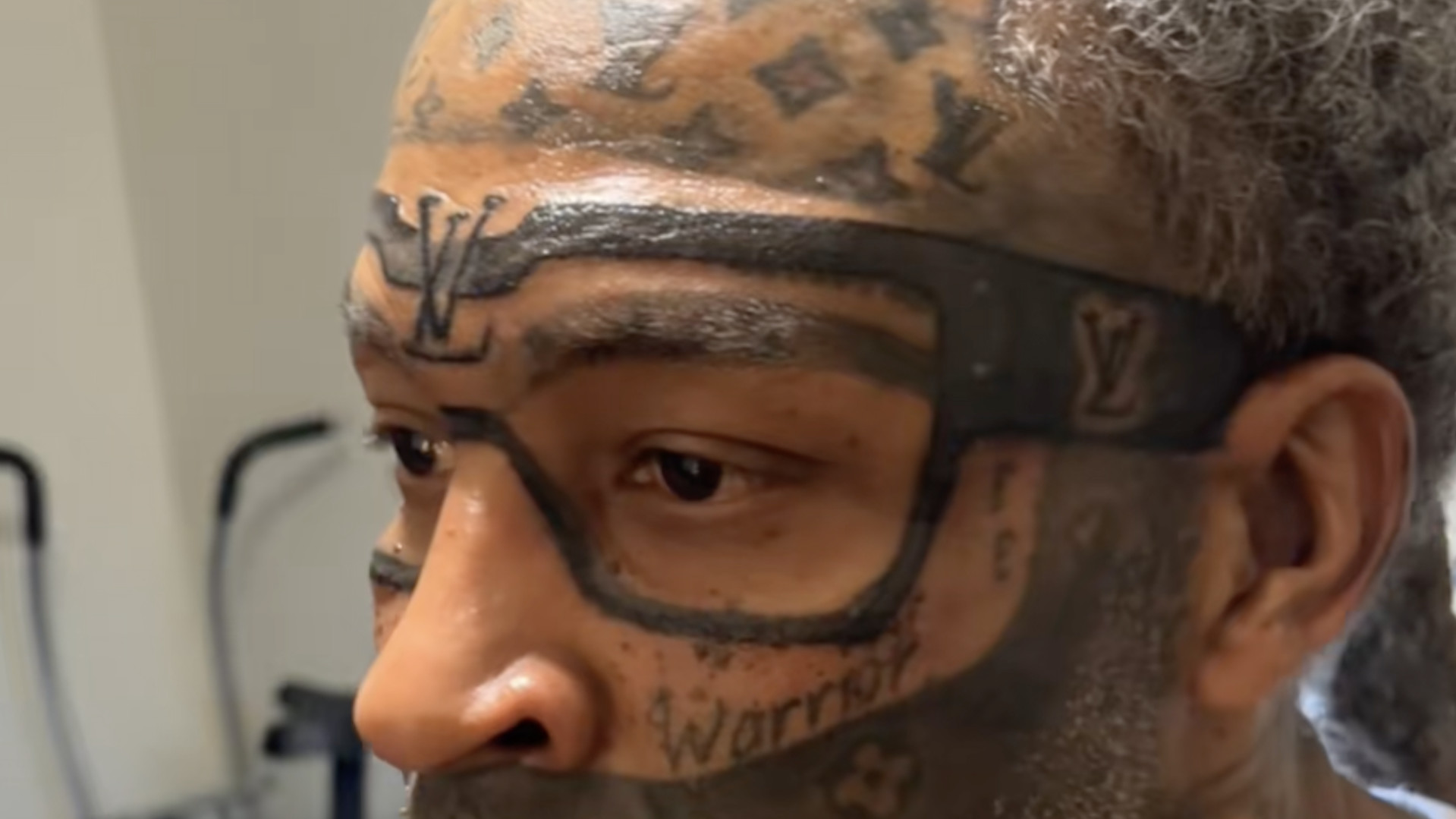 Man goes viral again for tattooing Louis Vuitton glasses on his face