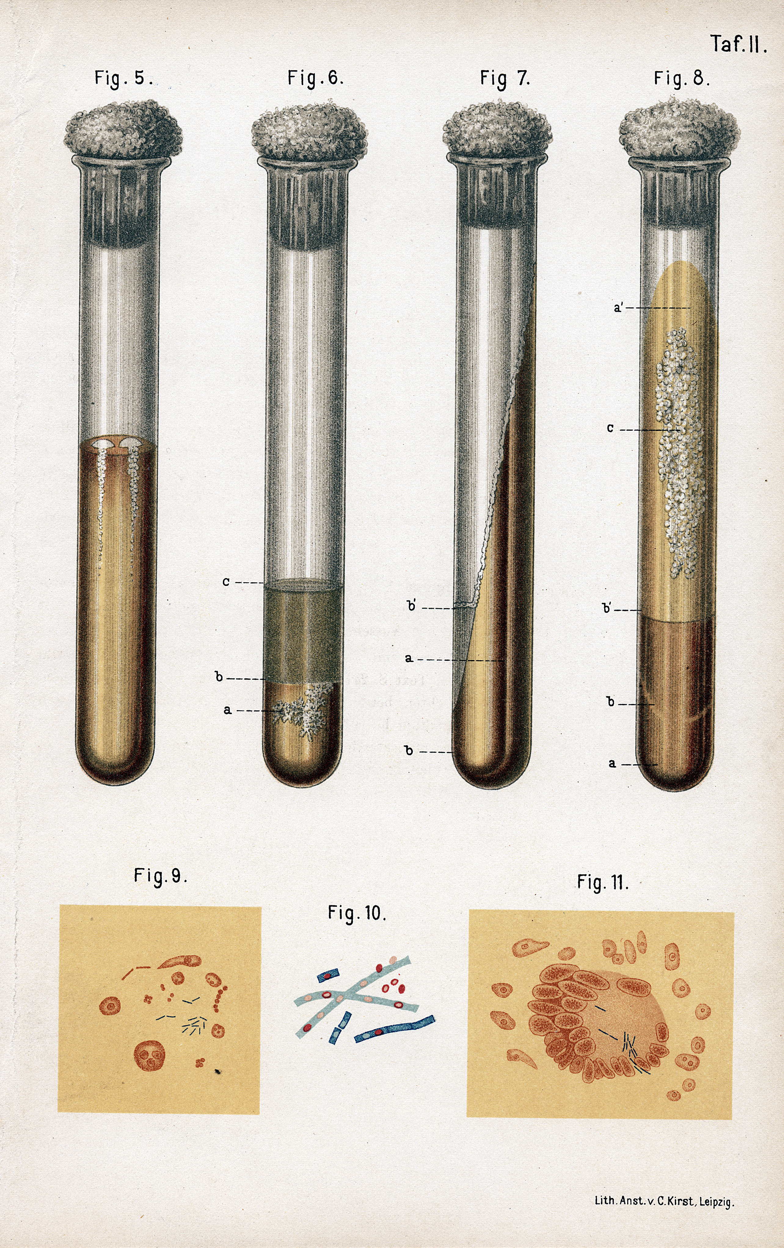 The world’s deadliest infectious disease is on the rise in the US<br>