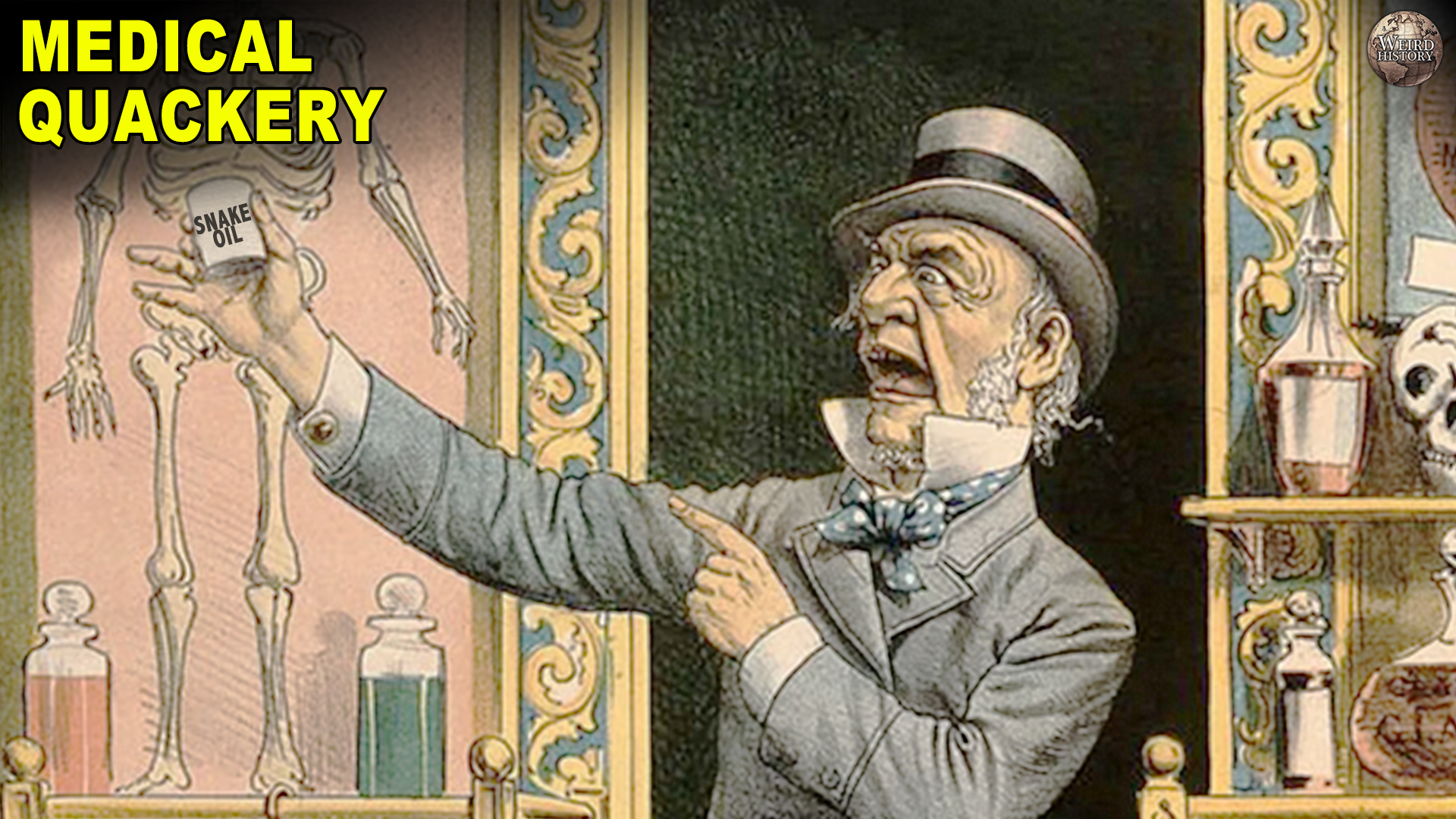 Bizarre medical practices from history