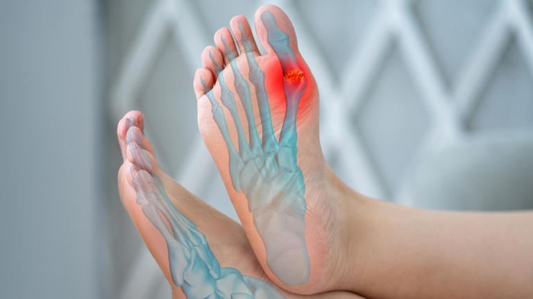 Oprah Winfrey's 'Ozempic feet' rumor is actually based in science