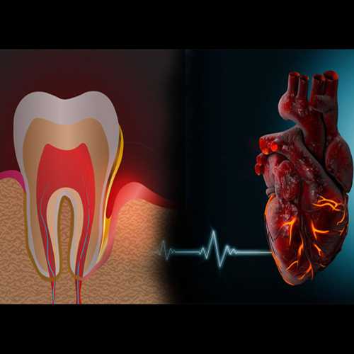 The surprising link between oral health and heart health