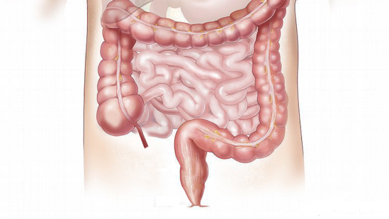 Oncologist explains why right-sided colon cancer is a 'silent danger ...