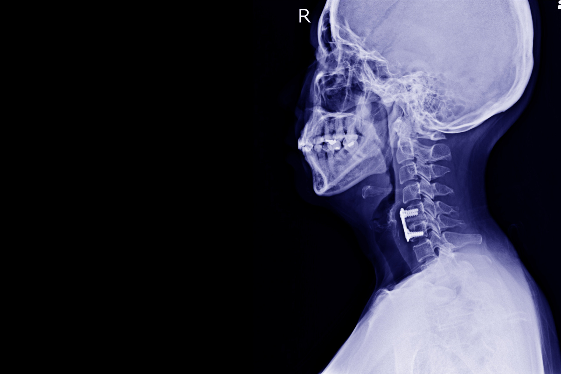 The most painful injuries and conditions humans can experience