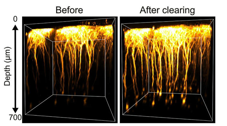 Scientists make live brain transparent
