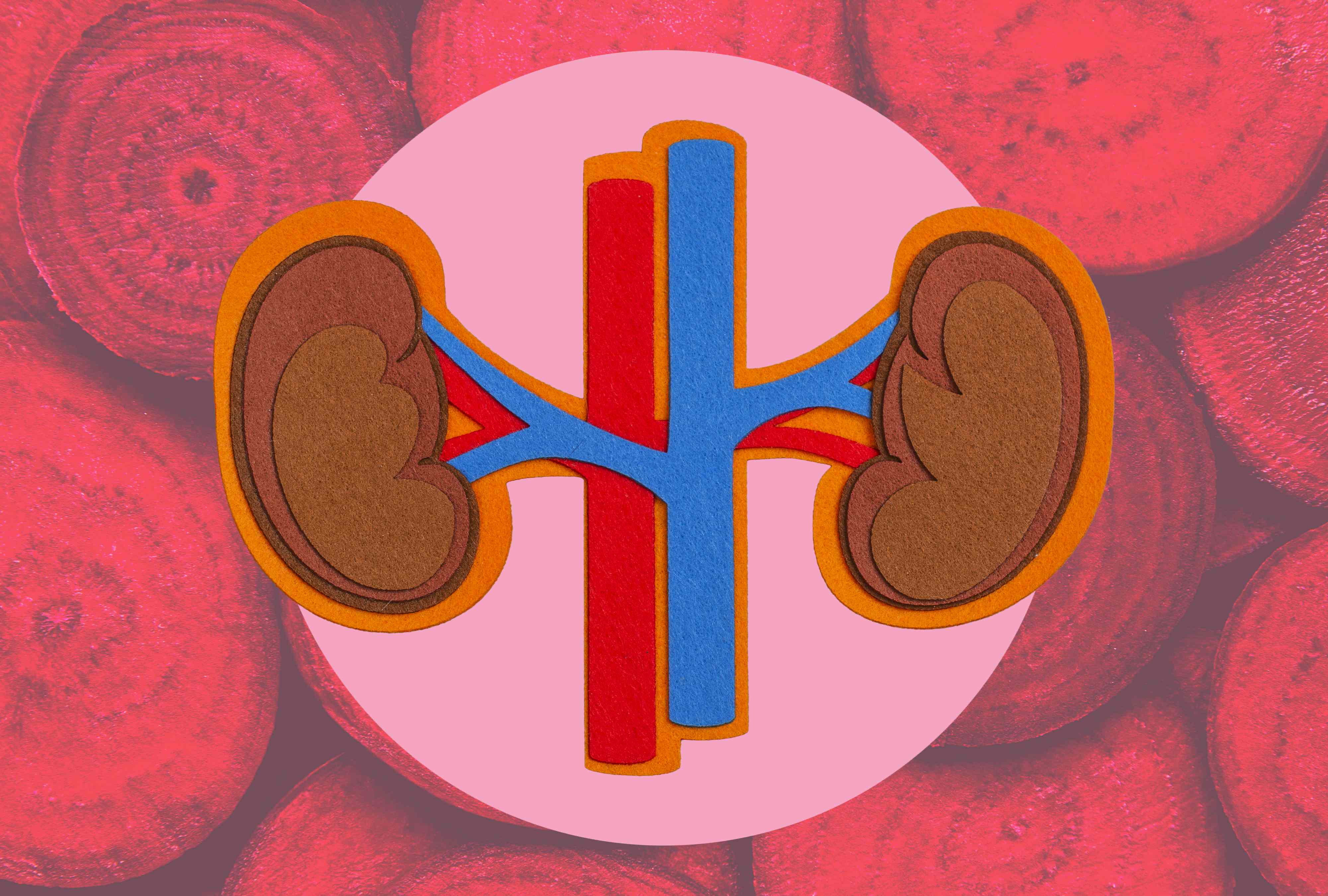 What happens to your kidneys when you eat beets