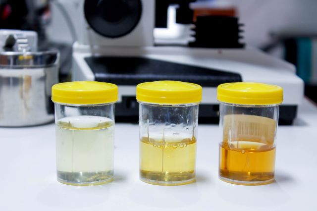 Researchers use urine to make breakthrough in fuel cell project